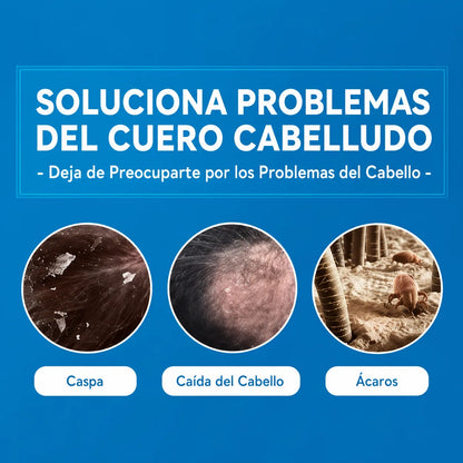 Shampoo Anticaspa ¡Dile adiós al picor constante en el cuero cabelludo!