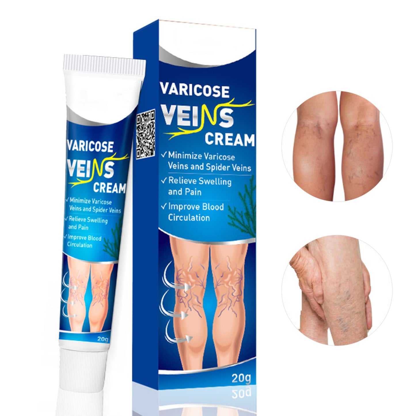 ¡CREMA PARA MEJORAR LA CIRCULACIÓN Y ELIMINAR VARICES!