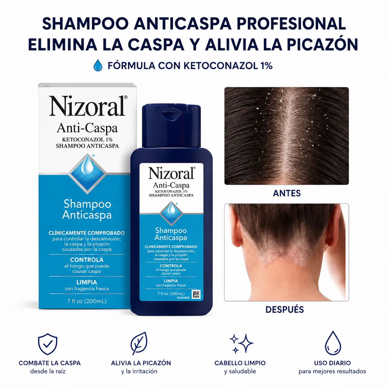 Shampoo Anticaspa ¡Dile adiós al picor constante en el cuero cabelludo!