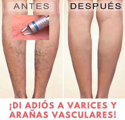 ¡CREMA PARA MEJORAR LA CIRCULACIÓN Y ELIMINAR VARICES!