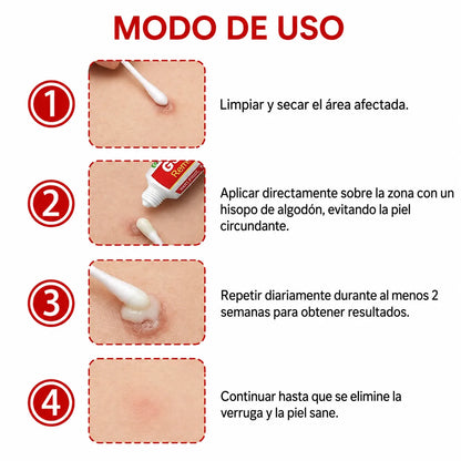 CREMA REMOVEDORA DE VERRUGAS ¡Sin dolor, aplicación suave y 100% natural!
