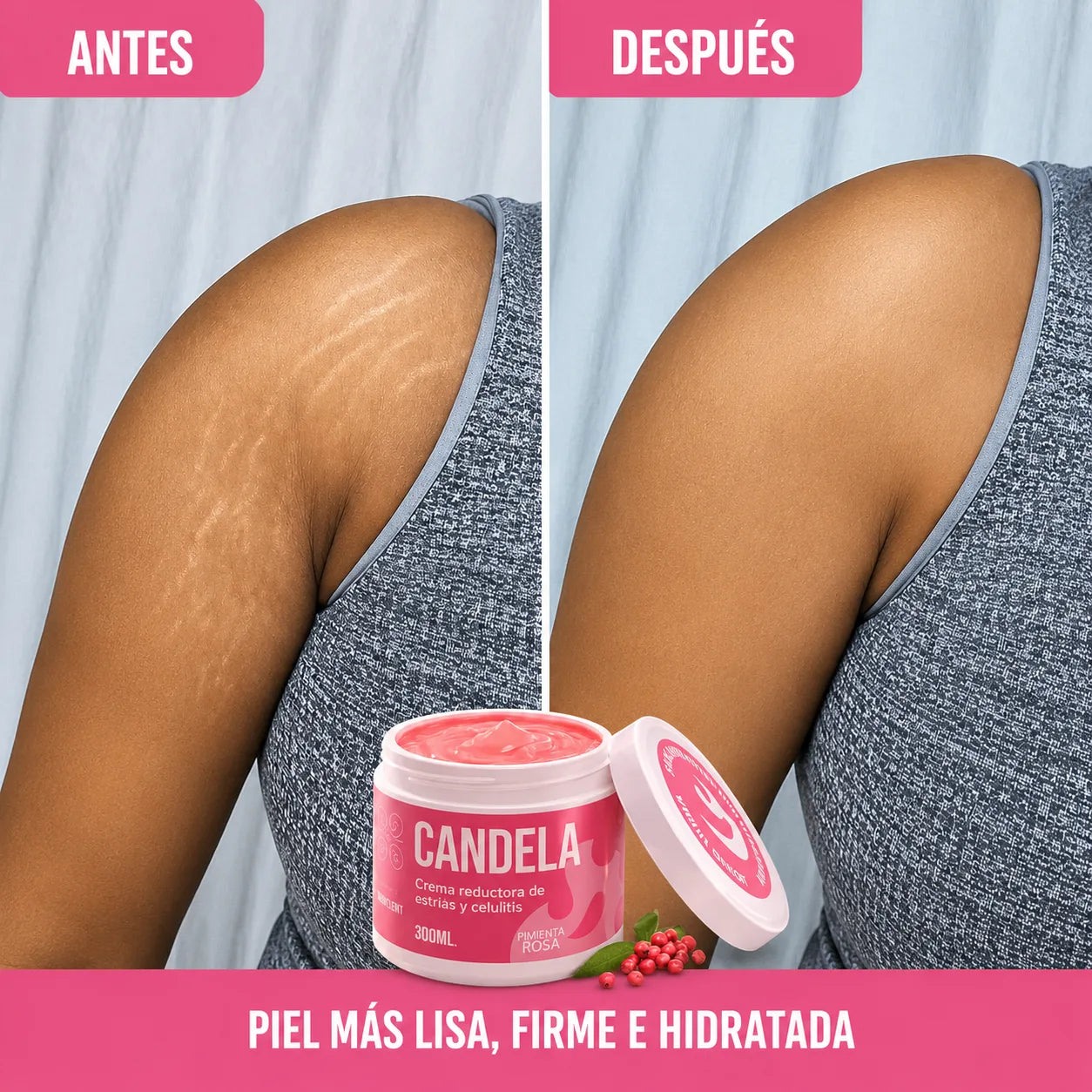 Candela ¡Piel Más Firme, Estrías Menos Visibles!
