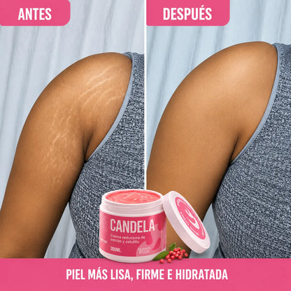 Candela ¡Piel Más Firme, Estrías Menos Visibles!