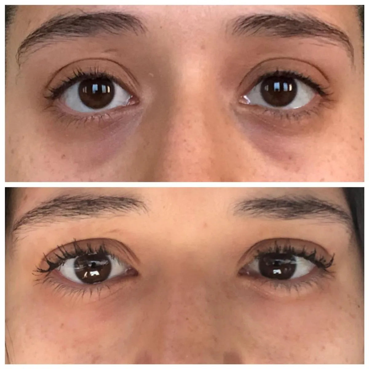 Crema para el contorno de ojos ¡Vibra, desinflama y rejuvenece tu mirada!