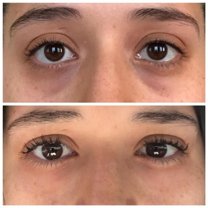 Crema para el contorno de ojos ¡Vibra, desinflama y rejuvenece tu mirada!